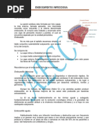 Endocarditis Infecciosa