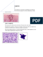 Diferenciacion 20 Anaplasia