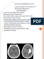 Accidentul Vascular Cerebral (Avc) Hemoragic