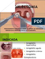 Amigdalectomia - Adenoidetomia