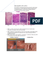 Onco Neoplasias