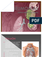 NEUMONÍAS