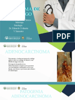 Carcinoma de Esofago