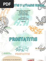 Prostatitis y Litiasis Renal