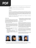 Orthodontic Treatment of Severe Crowding Malocclusion With Extraction of Premolars