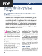 7 Articulo Bone-Anchored Maxillary Protraction in A Patient With Complete Cleft Lip and Palate: A Case Report