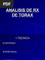 Descripcion de RX de Torax