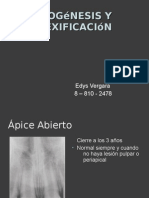 Apexogénesis y Apexificación