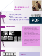 La Radiographie en Endodontie:: Incidences Développement Lecture de Clichés