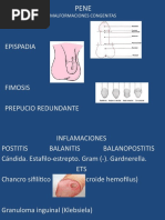 Hipospadia Epispadia: Malformaciones Congenitas