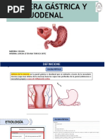 Úlcera Gástrica y Duodenal