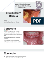 Mucocele y Ránula