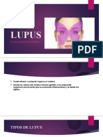 Lupus