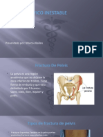 Trauma Pélvico Inestable: Presentado Por: Marcos Ballen