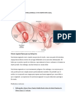 Dx1 Hernia Inguinal Unilateral O No Especificada