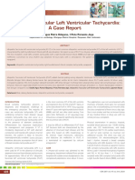 Idiopathic Fascicular Left Ventricular Tachycardia: A Case Report