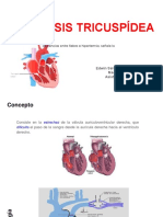 Valvulopatía Aortica, Pulmonñar y Tricuspidea