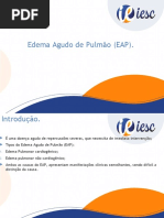 Edema Agudo de Pulmão (EAP)