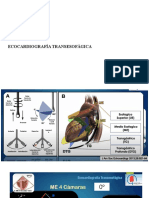 Ecocardiografía Transesofágica