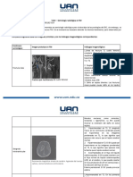 Taller - Semiología Radiológica en RM