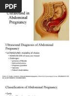 Abdominal Pregnancy