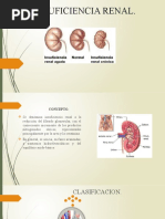 Insuficiencia Renal