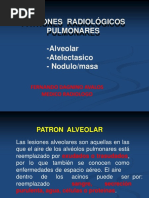 Dpi Patrones Alveolar, Atelectasico, Nodulo, Masa