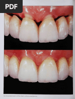 The Diagnostic Template A KeyElement To The ComprehensiveEsthetic Treatment Concept