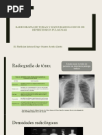 Radiografia de Torax y Datos Radiologicos de Hipertension Pulmonar