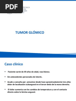 Tumor Glomico PDF