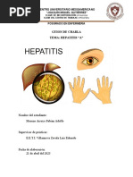 Hepatitis A