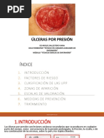 Úlceras Por Presión PDF