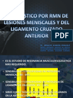 7-Mri Meniscos y Lca