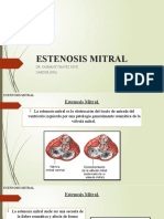 Estenosis Mitral