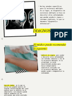 Esclerosis Multiple (Diagnostico, Tratamiento, Pososlogia)