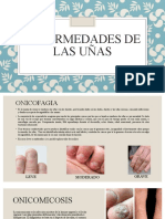 Enfermedades de Las Uñas