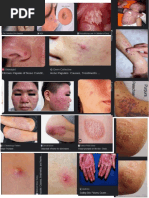 Skin Lesion Pics