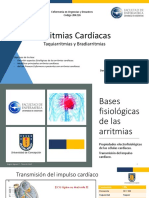 Arritmias Cardiacas