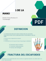 Fracturas de La Mano