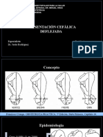 Presentación Cefálica Deflejada