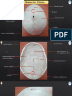 Imagenes Cabeza y Cuello Rotuladas Corregida