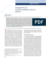 Orthodontic Management of A Horizontally Impacted Maxillary Incisor in An Adolescent Patient