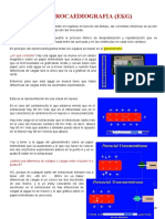 Electrocardiografia EKG