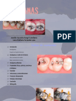 Amalgamas Operatoria