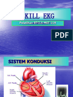 Ekg Skill 119