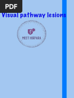 Visual Pathway Lesion