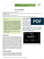 Ovarian Torsion in Pregnancy A Case Report