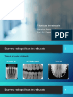 Tecnicas Intra