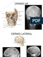 5.1 Incidências Todas As Partes Do Corpo