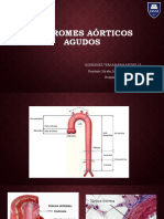 Síndromes Aórticos Agudos